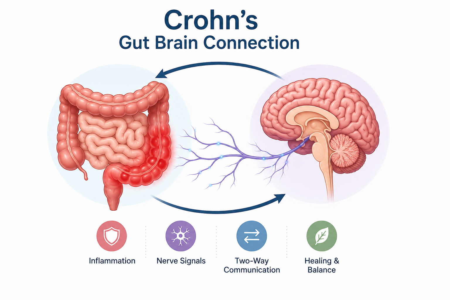 Crohn's gut brain connection